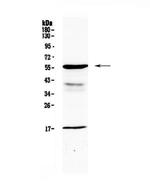 GALNS Antibody in Western Blot (WB)