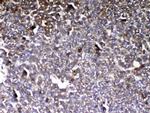 GC Antibody in Immunohistochemistry (Paraffin) (IHC (P))