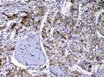 GC Antibody in Immunohistochemistry (Paraffin) (IHC (P))