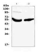 GC Antibody in Western Blot (WB)