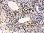 GNAQ Antibody in Immunohistochemistry (Paraffin) (IHC (P))