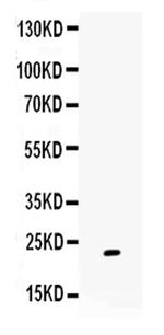 GREM1 Antibody in Western Blot (WB)