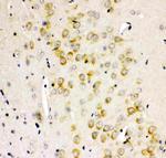 GluR2 Antibody in Immunohistochemistry (Paraffin) (IHC (P))