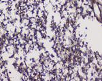 GRIK1 Antibody in Immunohistochemistry (Paraffin) (IHC (P))