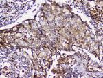 GRIK1 Antibody in Immunohistochemistry (Paraffin) (IHC (P))