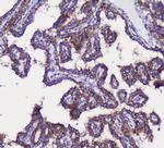 GRIK1 Antibody in Immunohistochemistry (Paraffin) (IHC (P))