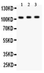 GRIK1 Antibody in Western Blot (WB)