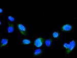 GRK2 Antibody in Immunocytochemistry (ICC/IF)