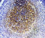 GRK2 Antibody in Immunohistochemistry (Paraffin) (IHC (P))