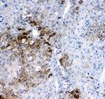 GSTA1/A2/A3/A4/A5 Antibody in Immunohistochemistry (Paraffin) (IHC (P))