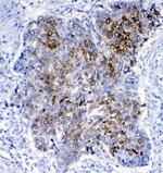 GSTA1/A2/A3/A4/A5 Antibody in Immunohistochemistry (Paraffin) (IHC (P))