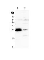 GSTA1/A2/A3/A4/A5 Antibody in Western Blot (WB)