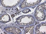 GSTM3 Antibody in Immunohistochemistry (Paraffin) (IHC (P))