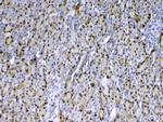 GSTP1 Antibody in Immunohistochemistry (Paraffin) (IHC (P))