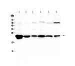 GSTP1 Antibody in Western Blot (WB)