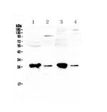 GSTT1 Antibody in Western Blot (WB)