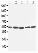 KIM-1 Antibody in Western Blot (WB)