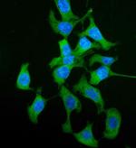 HGD Antibody in Immunocytochemistry (ICC/IF)