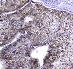 HGD Antibody in Immunohistochemistry (Paraffin) (IHC (P))