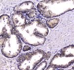 HGD Antibody in Immunohistochemistry (Paraffin) (IHC (P))