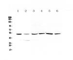 HGD Antibody in Western Blot (WB)