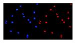 hnRNP A1 Antibody in Immunocytochemistry (ICC/IF)