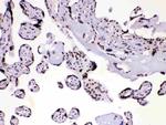 hnRNP A1 Antibody in Immunohistochemistry (Paraffin) (IHC (P))