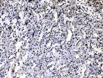 hnRNP A1 Antibody in Immunohistochemistry (Paraffin) (IHC (P))