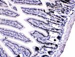 hnRNP A1 Antibody in Immunohistochemistry (Paraffin) (IHC (P))