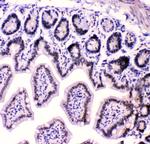 hnRNP F Antibody in Immunohistochemistry (Paraffin) (IHC (P))