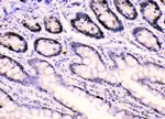 hnRNP F Antibody in Immunohistochemistry (Paraffin) (IHC (P))