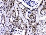 hnRNP F Antibody in Immunohistochemistry (Paraffin) (IHC (P))