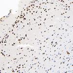 hnRNP L Antibody in Immunohistochemistry (Paraffin) (IHC (P))