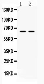 hnRNP L Antibody in Western Blot (WB)