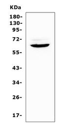 HPa1 Antibody in Western Blot (WB)