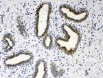 HSD17B4 Antibody in Immunohistochemistry (Paraffin) (IHC (P))