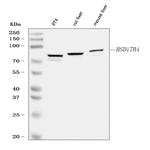 HSD17B4 Antibody in Western Blot (WB)