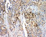 HSD17B4 Antibody in Immunohistochemistry (Paraffin) (IHC (P))