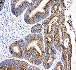 HSD17B4 Antibody in Immunohistochemistry (Paraffin) (IHC (P))