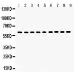 HSP60 Antibody in Western Blot (WB)