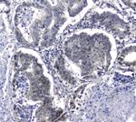 HSP105 Antibody in Immunohistochemistry (Paraffin) (IHC (P))