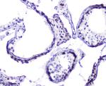 HSP105 Antibody in Immunohistochemistry (Paraffin) (IHC (P))