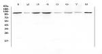 HSP105 Antibody in Western Blot (WB)