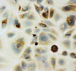 HYAL1 Antibody in Immunocytochemistry (ICC/IF)