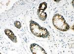 HYAL1 Antibody in Immunohistochemistry (Paraffin) (IHC (P))