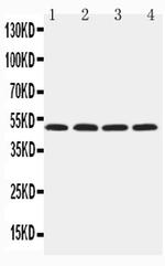 HYAL1 Antibody in Western Blot (WB)