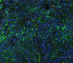 ICAM-1 (CD54) Antibody in Immunohistochemistry (Paraffin) (IHC (P))