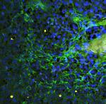 ICAM-1 (CD54) Antibody in Immunohistochemistry (Paraffin) (IHC (P))