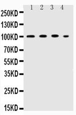 ICAM-1 (CD54) Antibody in Western Blot (WB)