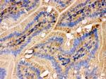 IDH2 Antibody in Immunohistochemistry (IHC)